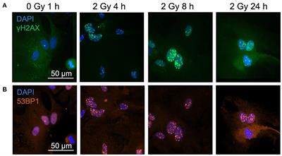 Unraveling astrocyte behavior in the space brain: Radiation response of primary astrocytes